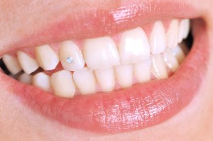 Smile of a woman
